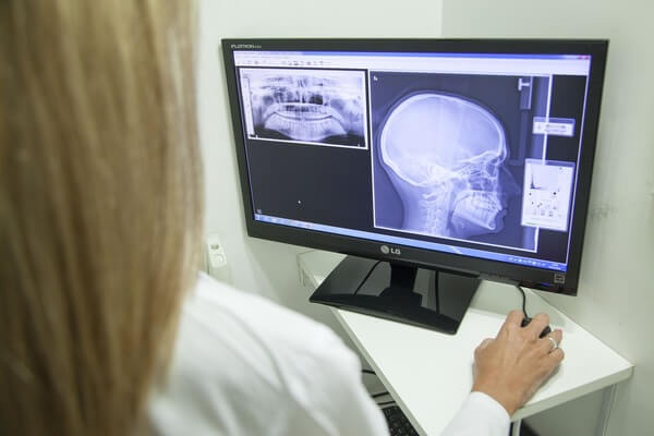 Access to HE Radiography